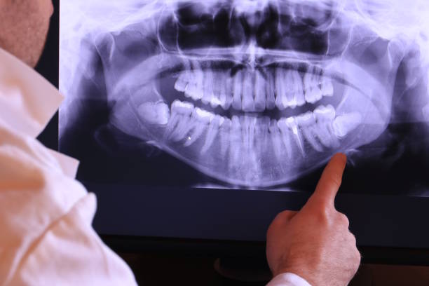 Best Weekend Emergency Dentist in Stanwood, WA